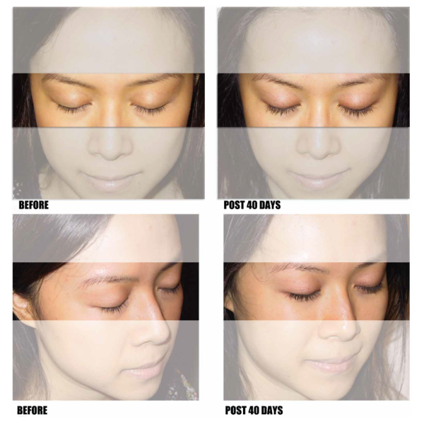 Nutraluxe Lash MD 3ml - Image 5
