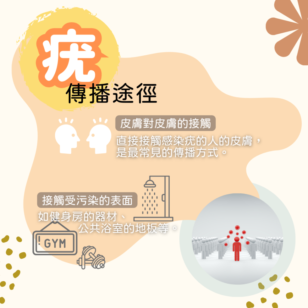 疣是經皮膚對皮膚的接觸,或接觸受污染的表面. 在公共地方記住要着拖鞋中