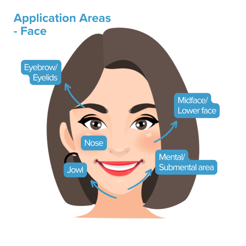 aptos threadlift nano excellence method, application area on face, eyebrow, eyelid, nose, jowl, midface, lowerface, cheek, jawline, mental area, submental area. medical aesthetics clinic in Tsim Sha Tsui Mira Place, Hong Kong. Experienced Doctor.