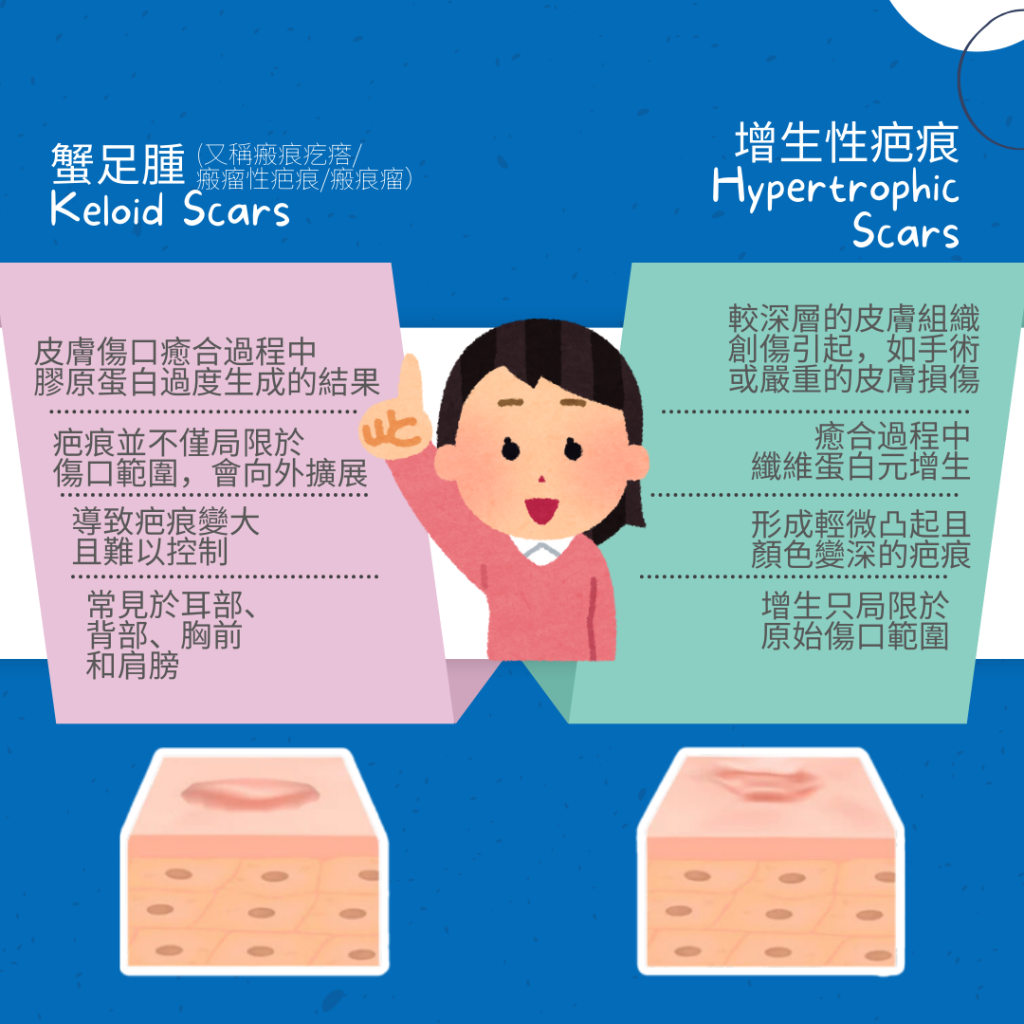 蟹足腫 增生性疤痕