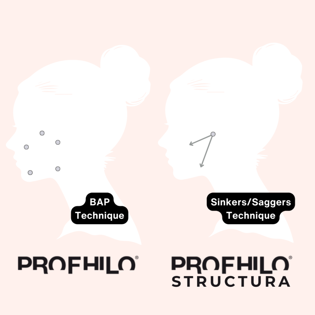 profhilo structura 注射技巧 BAP technique Sinker Sagger technique profhilo structura 新舊針比較