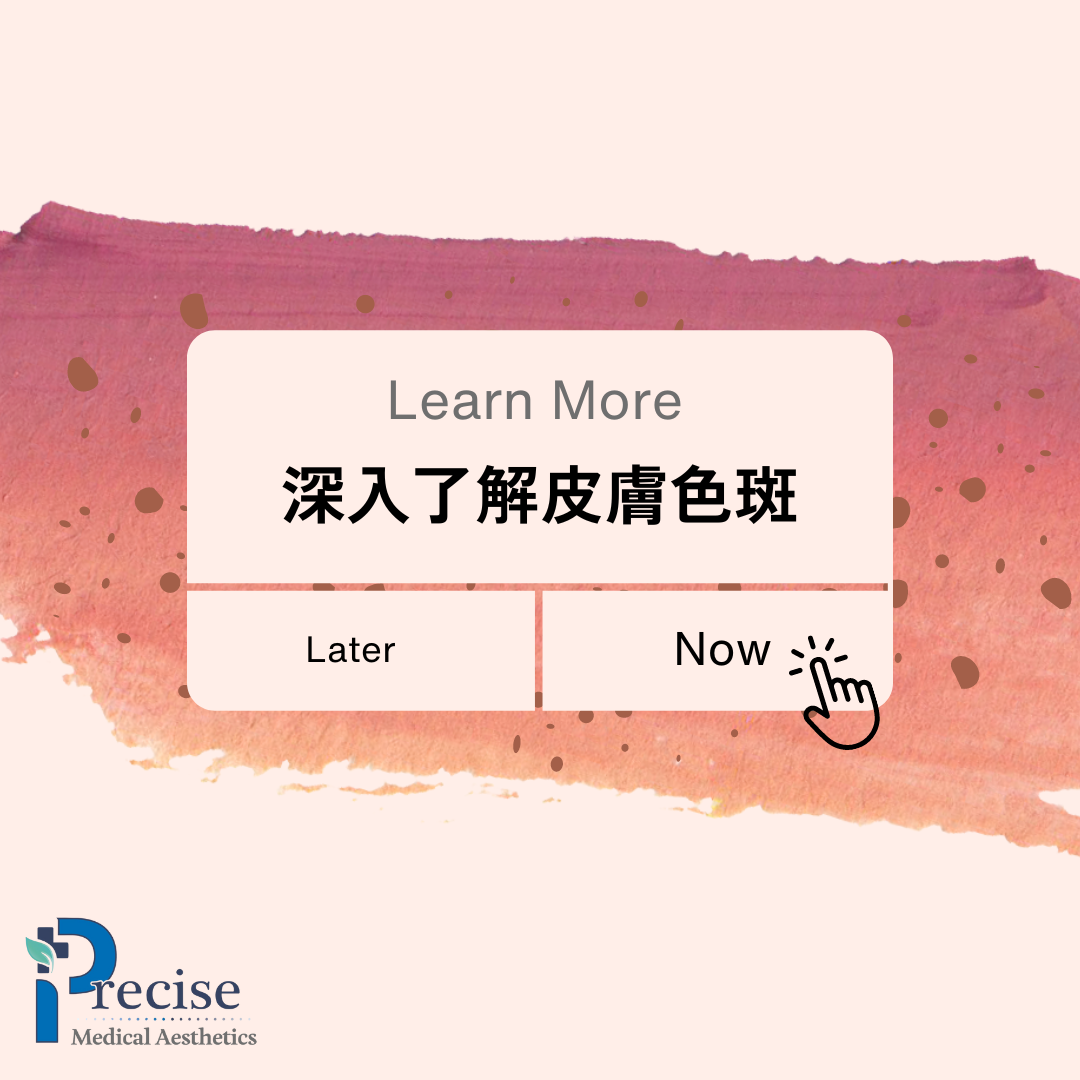 色斑懶人包, 一文拆解色斑成因、種類、解決方法.醫生教你認識常見色斑.了解色斑形成的原因、種類及去除方法！