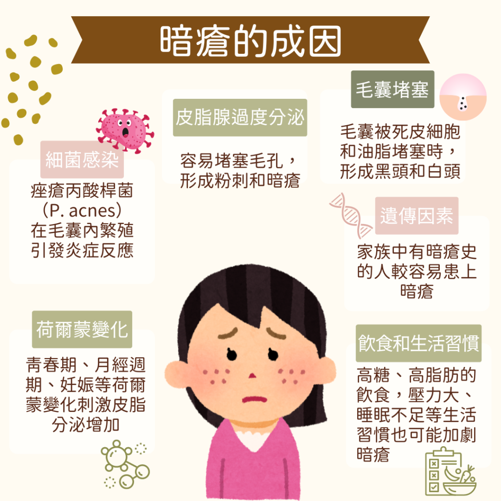 為什麼會生暗瘡？ 暗瘡是如何形成的？