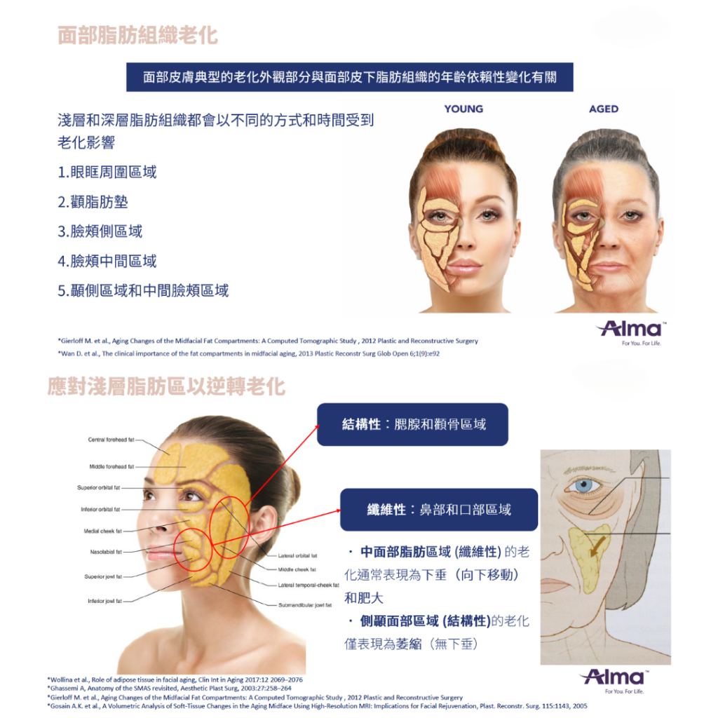 profhilo 全新 structura 療程有效恢復面部脂肪組織