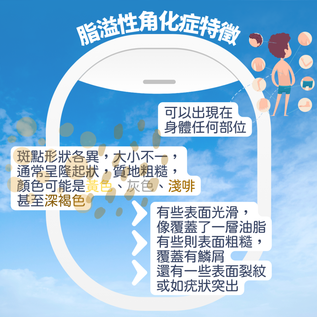 老人斑點分 老人斑特點
