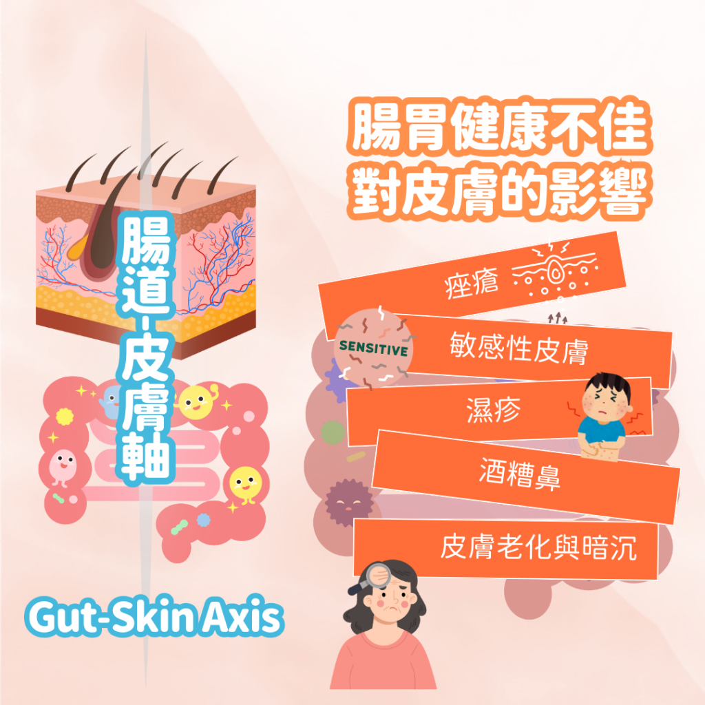 腸道皮膚軸 腸胃不佳對皮膚影響