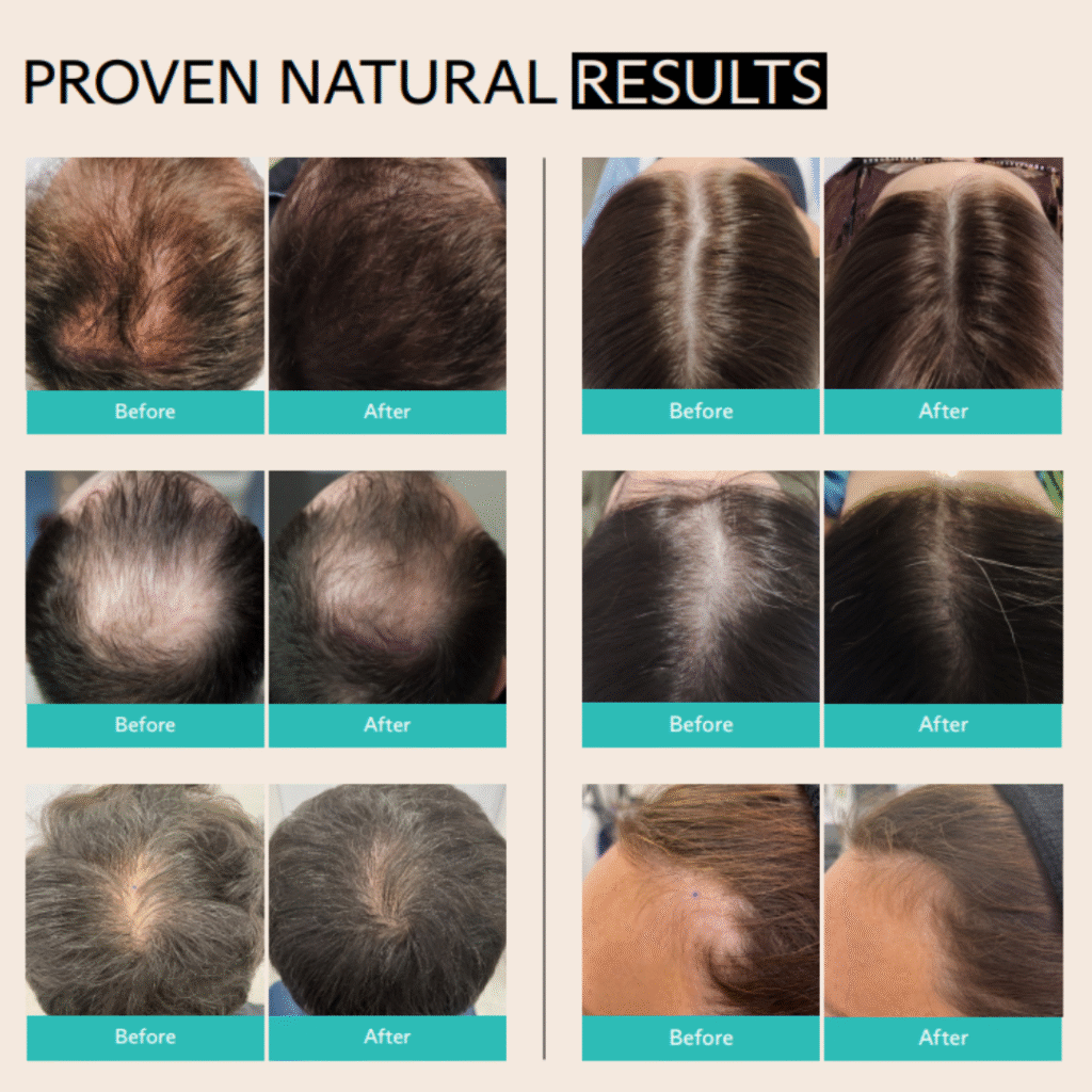 Folix result before after