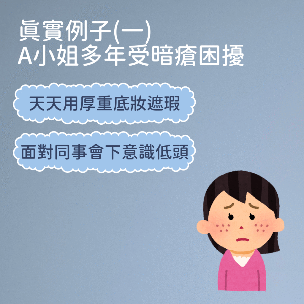 暗瘡問題 暗瘡困擾