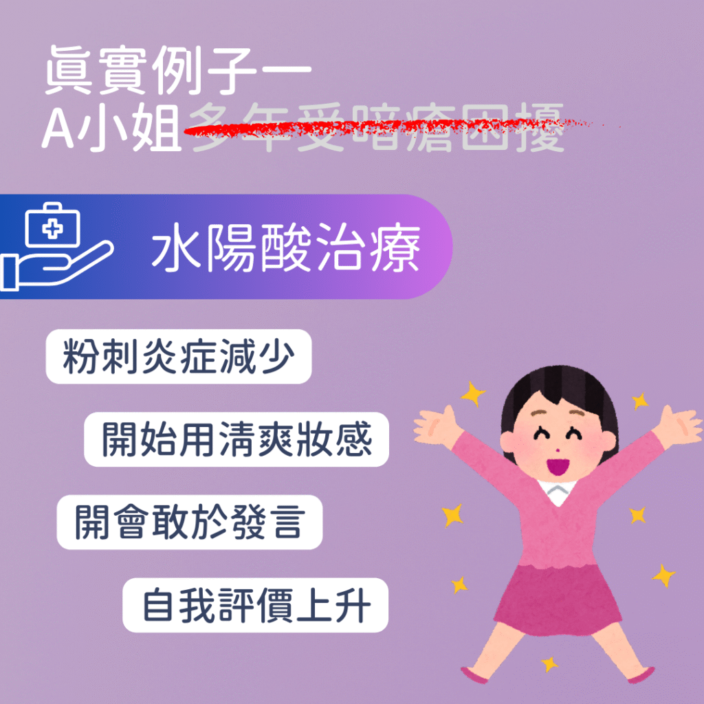 暗瘡水陽酸治療 減少炎症